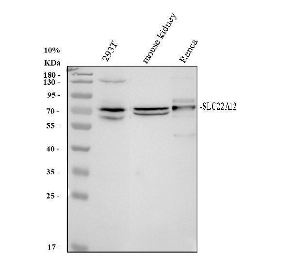 Western blot analysis of URAT1/SLC22A12 using anti-URAT1/SLC22A12 antibody (A02515-2)