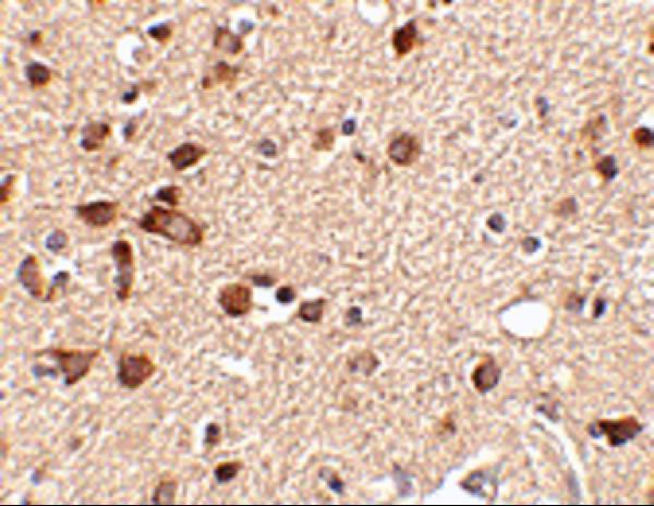 Immunohistochemistry of Stk39 in human brain tissue with Stk39 antibody at 2
