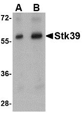 Western blot analysis of Stk39 in rat brain tissue lysate with Stk39 antibody at (A) 1 and (B) 2 μg/mL