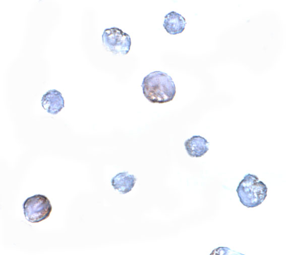 Immunocytochemistry of PDCD5 in Jurkat cells with PDCD5 antibody at 5 μg/mL