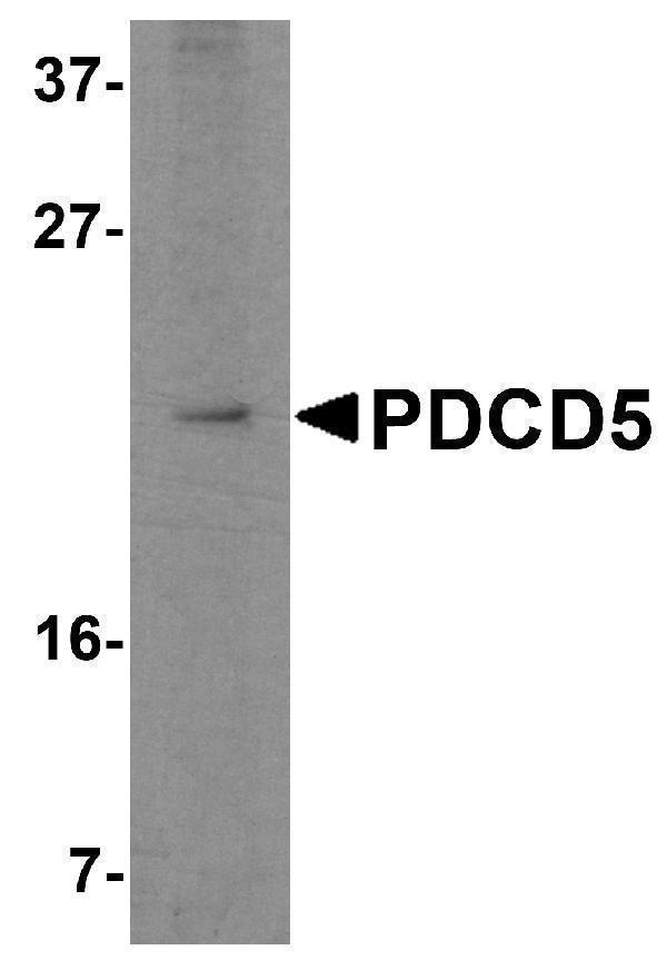 Western blot analysis of PDCD5 in Jurkat cell lysate with PDCD5 antibody at 2