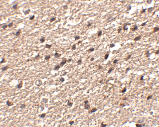 a02516 stk39 primary antibodies ihc testing 2