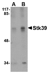 a02516 stk39 primary antibodies wb testing 1