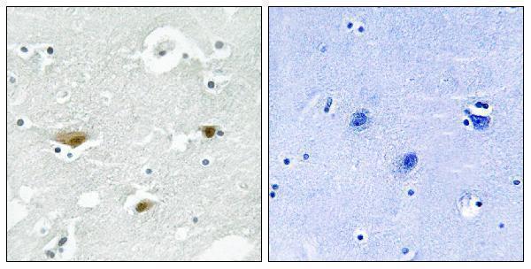 Immunohistochemistry analysis of paraffin-embedded human brain, using STK39 (Phospho-Ser325) Antibody