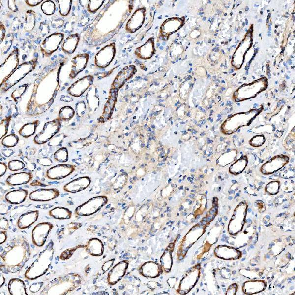  IHC analysis of Milk Fat Globule 1/MFGE8 using anti-Milk Fat Globule 1/MFGE8 antibody (A02518-3)