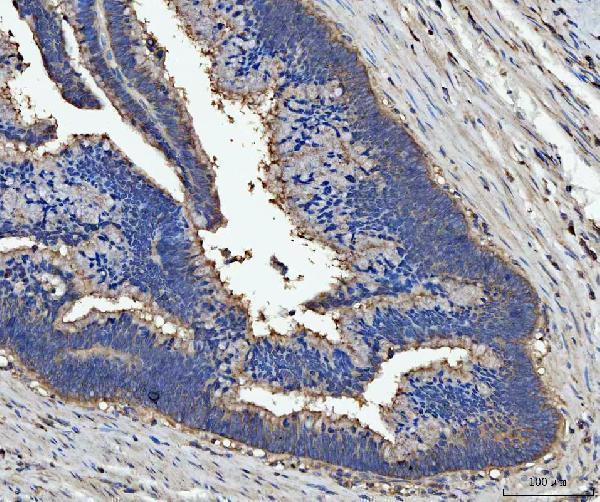  IHC analysis of Milk Fat Globule 1/MFGE8 using anti-Milk Fat Globule 1/MFGE8 antibody (A02518-3)