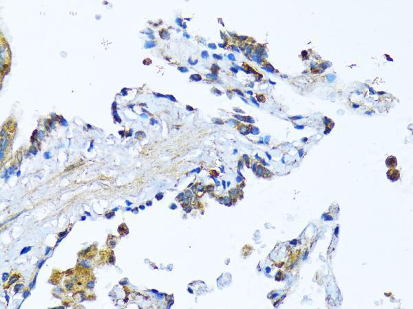 Immunohistochemistry of paraffin-embedded Human lung using MFGE8 antibody  at dilution of 1:100 