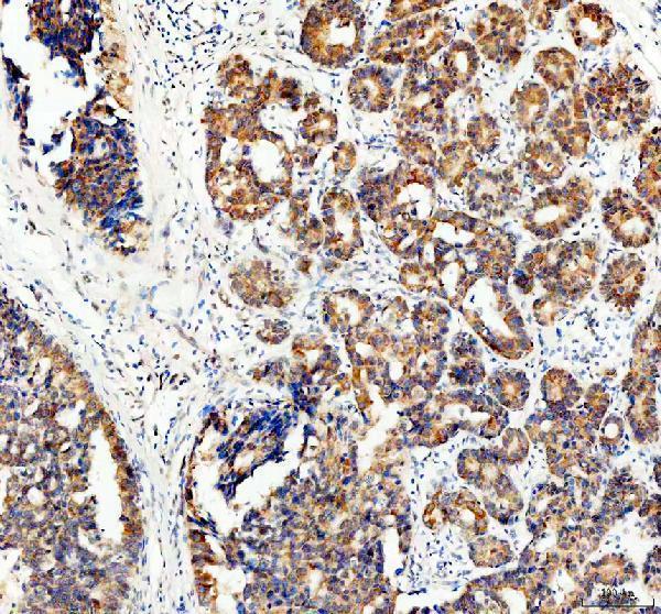 a02519 1 ece1 primary antibodies ihc testing 1