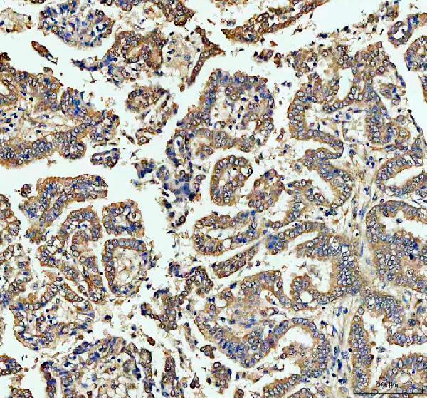 a02519 1 ece1 primary antibodies ihc testing 2
