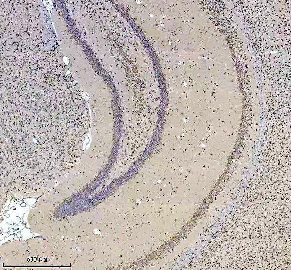 IHC analysis of PURA using anti-PURA antibody (A02520-1)
