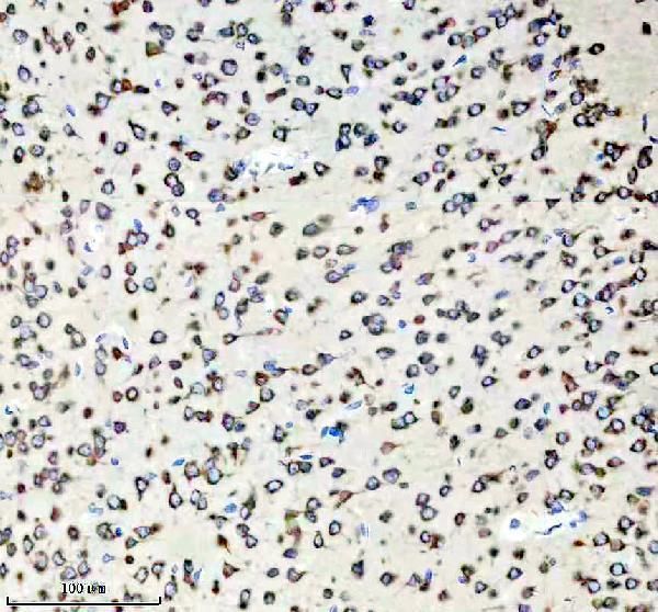 IHC analysis of PURA using anti-PURA antibody (A02520-1)