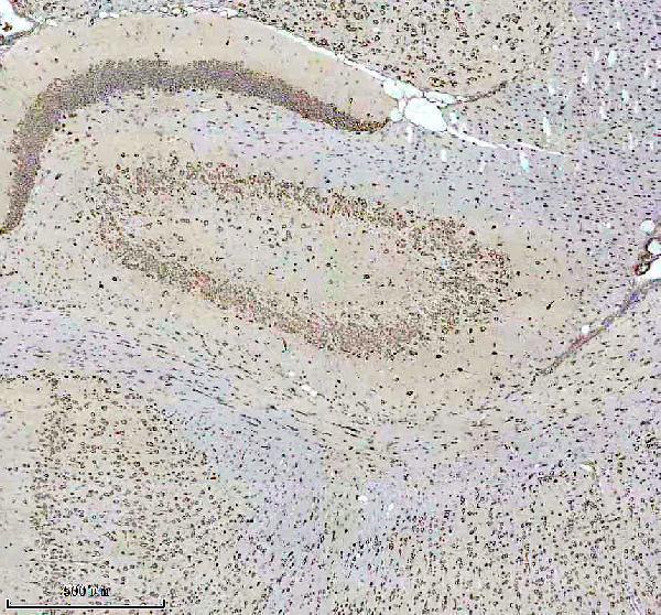 a02520 1 pura primary antibodies ihc testing 3