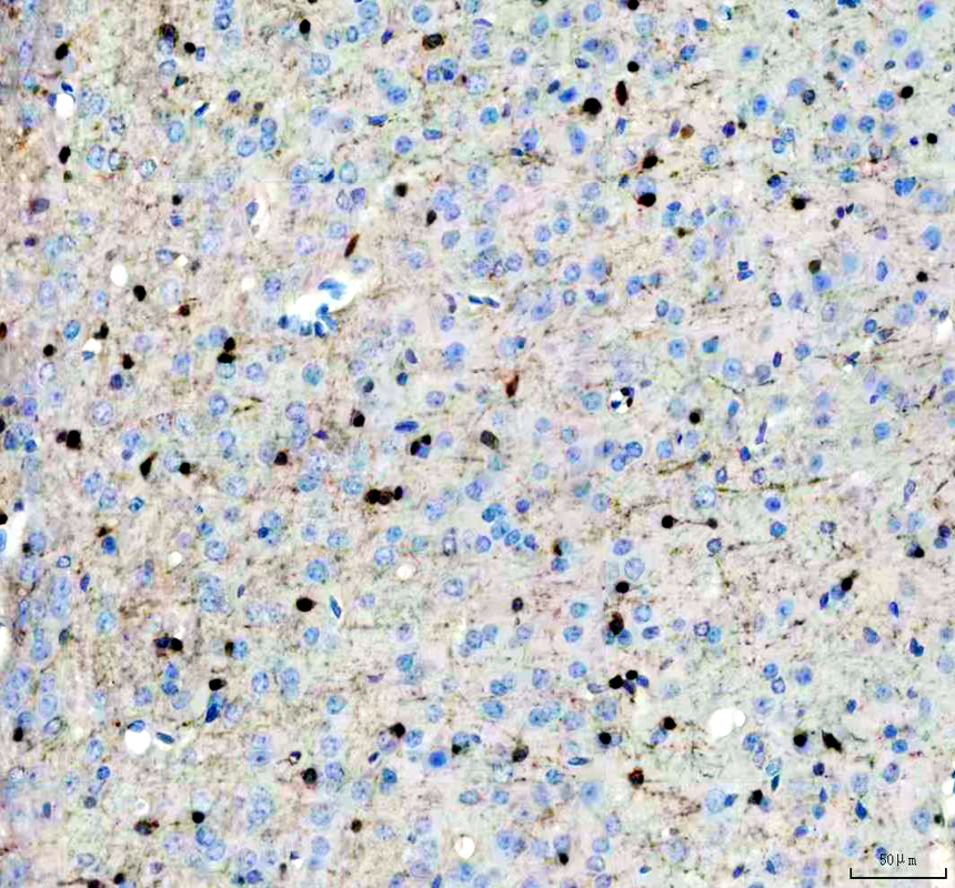 IHC analysis of DLX5 using anti-DLX5 antibody (A02523-2)