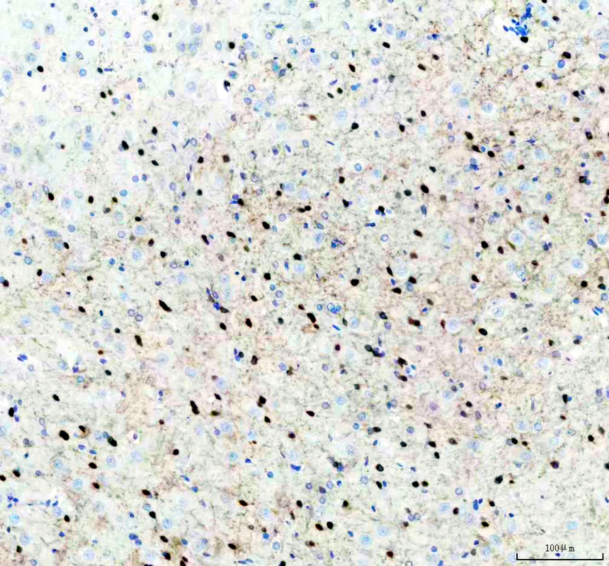IHC analysis of DLX5 using anti-DLX5 antibody (A02523-2)