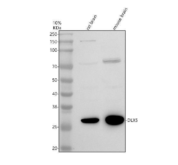 Western blot analysis of DLX5 using anti-DLX5 antibody (A02523-2)
