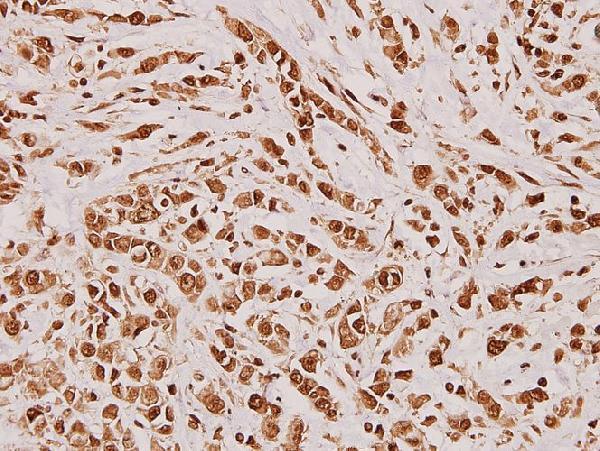 a02523 dlx5 primary antiboties ihc testing 2