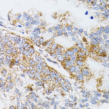 a02529 2 pdyn primary antiboties ihc testing 4