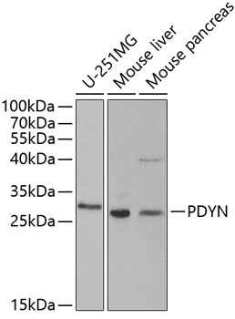 Western blot analysis of extracts of various cell lines, using PDYN antibody  at 1:1000 dilution