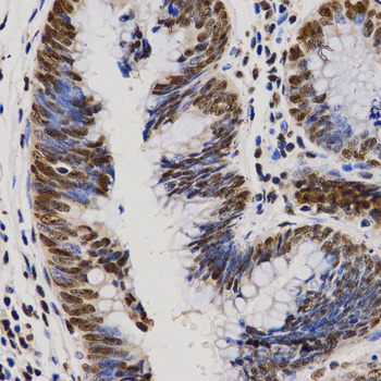 a02530 pelp1 primary antiboties if testing 2