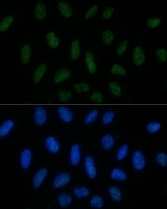 a02530 pelp1 primary antiboties if testing 3