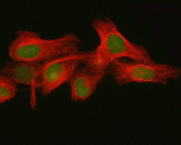  IF analysis of Fbx32/FBXO32 using anti-Fbx32/FBXO32 antibody (A02531-1) and anti-Beta Tubulin antibody (M01857-3)