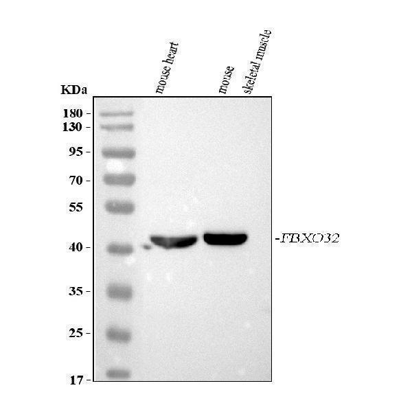  Western blot analysis of Fbx32/FBXO32 using anti-Fbx32/FBXO32 antibody (A02531-1)