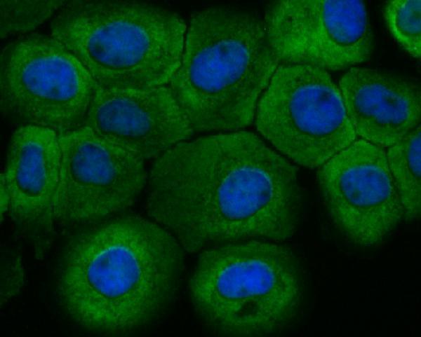 a02531 fbxo32 primary antiboties icc testing 2