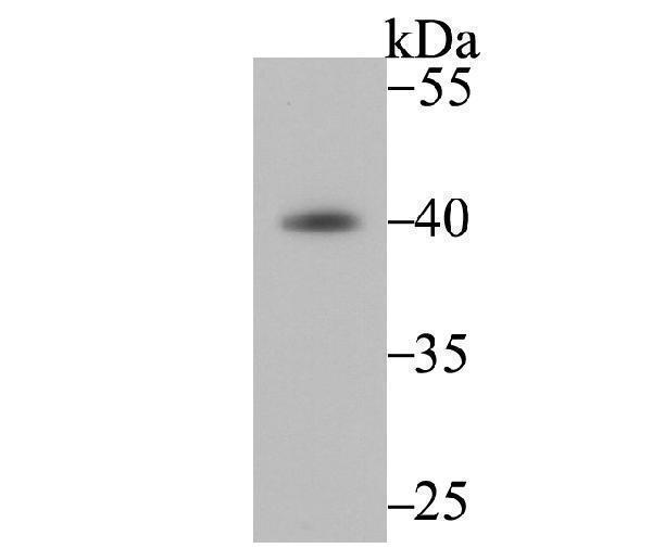 a02531 fbxo32 primary antiboties wb testing 1