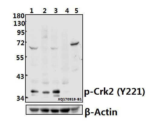 Western blot (WB) analysis of Crk2 (phospho-Y221) pAb at 1:500 dilution
Lane1:A549 whole cell lysate(40ug)
Lane2:Hela whole cell lysate(40ug)
Lane3:MCF-7 whole cell lysate(40ug)
Lane4:The Kidney tissue lysate of Rat(40ug)
Lane5:The Kidney tissue lysate of Mouse(40ug)