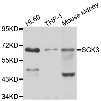 a02534 sgk3 primary antiboties wb testing 1