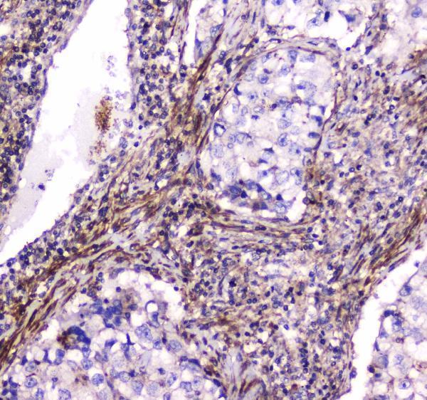 a02536 2 dynamin_1 primary antibodies ihc testing 2