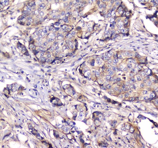 a02536 2 dynamin_1 primary antibodies ihc testing 3