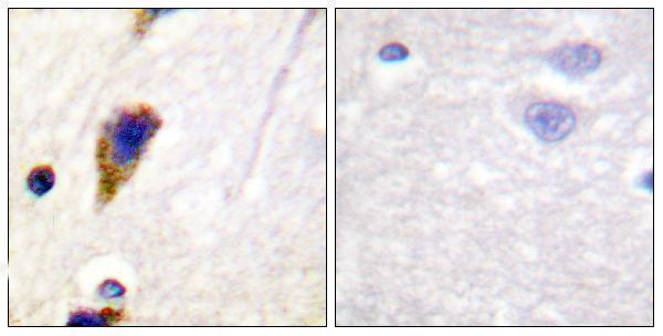 a02536 dnm1 primary antibodies ihc testing 1