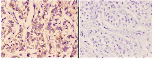a02537 1 bmx primary antiboties ihc testing 2
