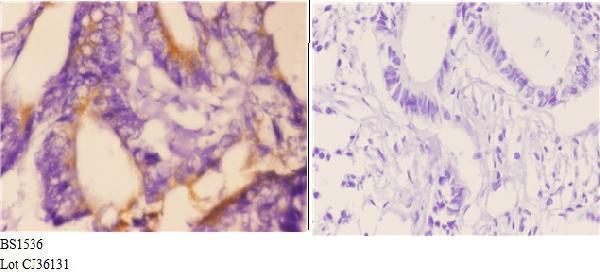a02537 1 bmx primary antiboties ihc testing 3