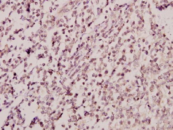 a02537y43 bmx primary antiboties ihc testing 2