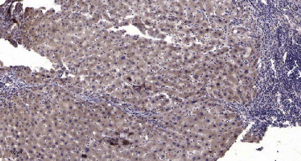 a02544 1 mum1 primary antibodies ihc testing 1
