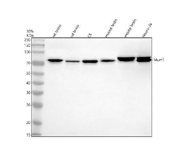 Western blot analysis of MUM1/PWWP3A using anti-MUM1/PWWP3A antibody (A02544-2)