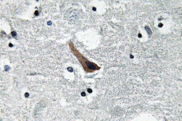Immunohistochemistry (IHC) analyzes of GABAA Rα1 (L361) pAb in paraffin-embedded human brain tissue