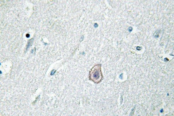 a02548 ptger3 primary antiboties ihc testing 2