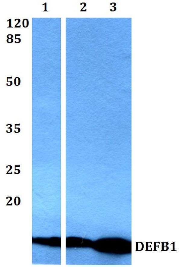 Western blot (WB) analysis of DEFB1 polyclonal antibody at 1:500 dilution
Lane1:HEK293T whole cell lysate
Lane2:Mouse liver tissue lysate
Lane3:Rat heart tissue lysate