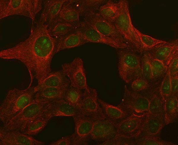  IF analysis of PGLS using anti-PGLS antibody (A02553-2) and anti-Beta Tubulin antibody (M01857-3)