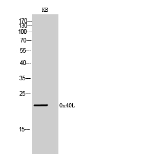 Western Blot analysis of KB cells using Ox40L Polyclonal Antibody