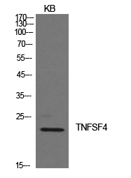 Western Blot analysis of KB cells using Ox40L Polyclonal Antibody
