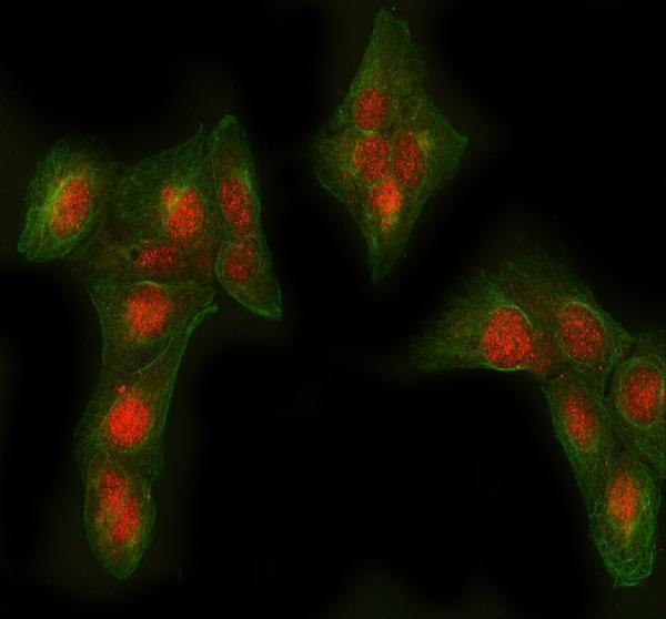  IF analysis of AGL using anti-AGL antibody (A02555) and anti-Beta Tubulin antibody (M01857-3)