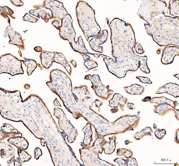  IHC analysis of AGL using anti-AGL antibody (A02555)