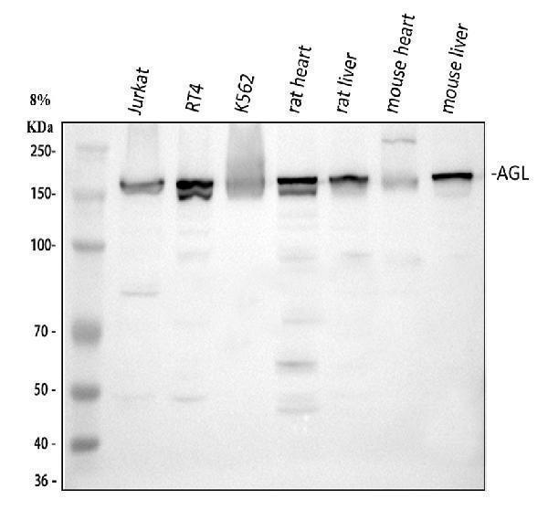  Western blot analysis of AGL using anti-AGL antibody (A02555)