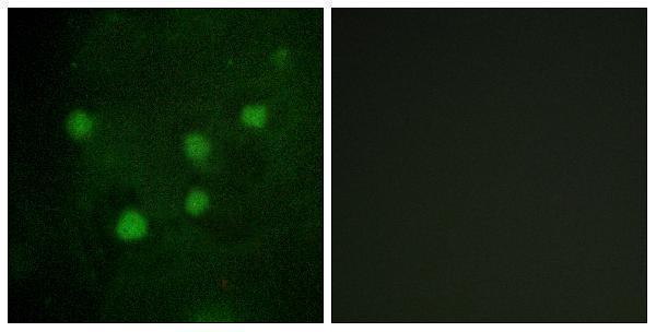 a02556 1 arid1b primary antibodies if testing 1