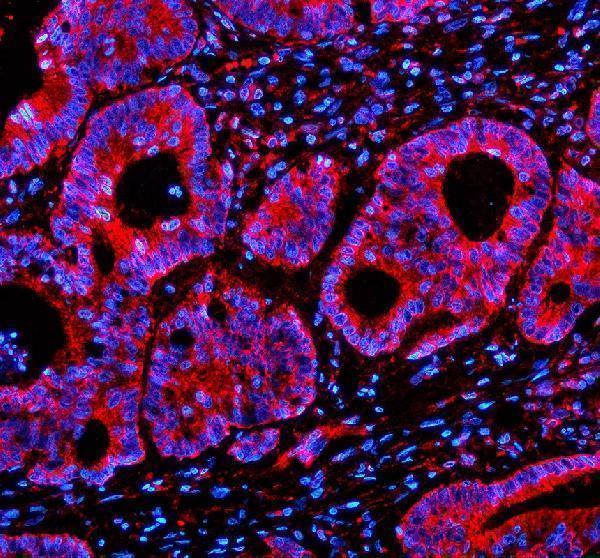 a02558 1 sesn2 primary antibodies if testing 1