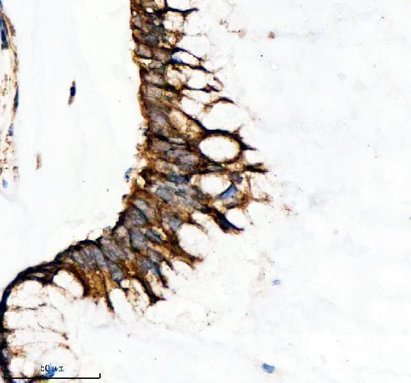 a02558 1 sesn2 primary antibodies ihc testing 3